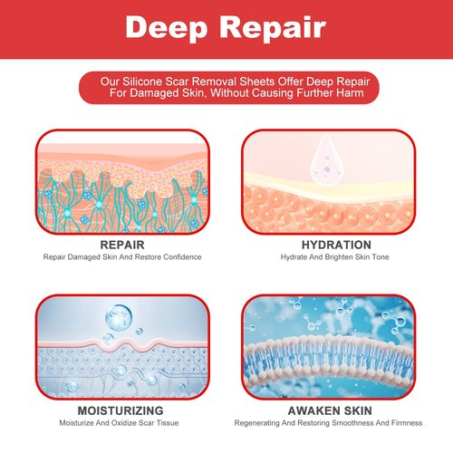 FRESINIDER Silicone Scar Sheets - Extra-Large 5.9"x2.4" for Enhanced Coverage | Pack of 8 for Effective Scar Treatment